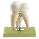 Upper First Three-Rooted Molar Model